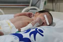 با اقدامات مرکز طبی کودکان، نوزاد رها شده با حال عمومی خوب ترخیص شد 
