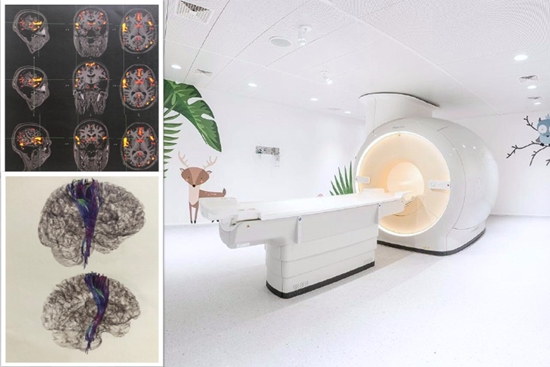 راه‌اندازی neuro advance imaging کودکان در واحد تصویربرداری بیمارستان مرکز طبی کودکان 